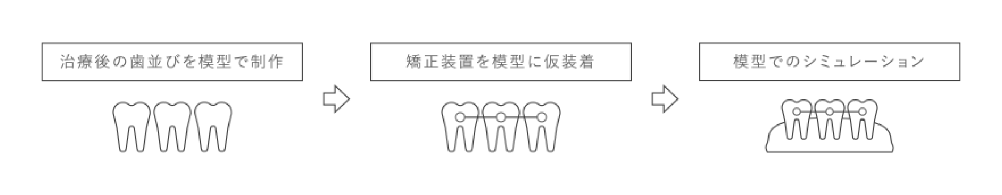 治療後の歯並びを模型で制作 矯正装置を模型に仮装着 模型でのシミュレーション